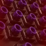 Topre switches with exposed stems.